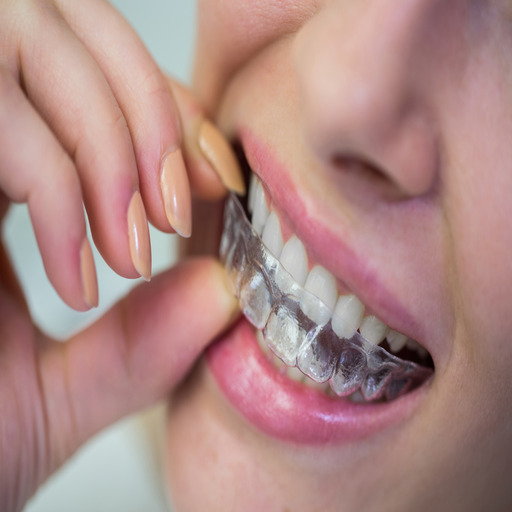 Attracting Orthodontic Patients: Lead Generation with Legit Exposure's Digital Strategies
